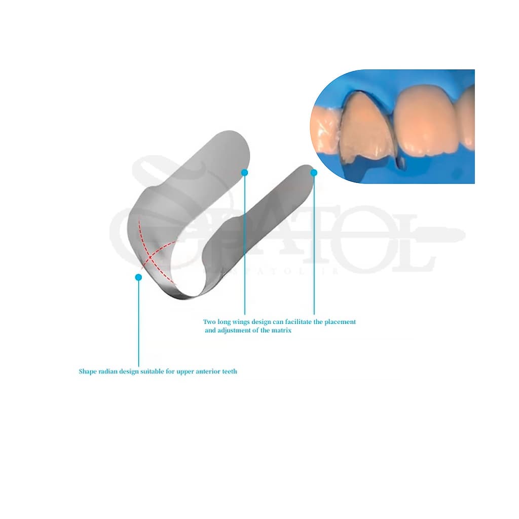نوار ماتریس ونیر Venner Matrix Bands Zt
