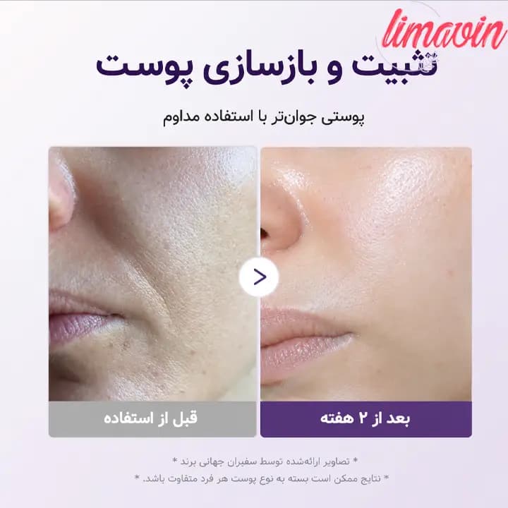 سرم جوانساز رتینول 1.9 درصد مدی کیوب حجم 30 میلی لیتر — تصویر ۵