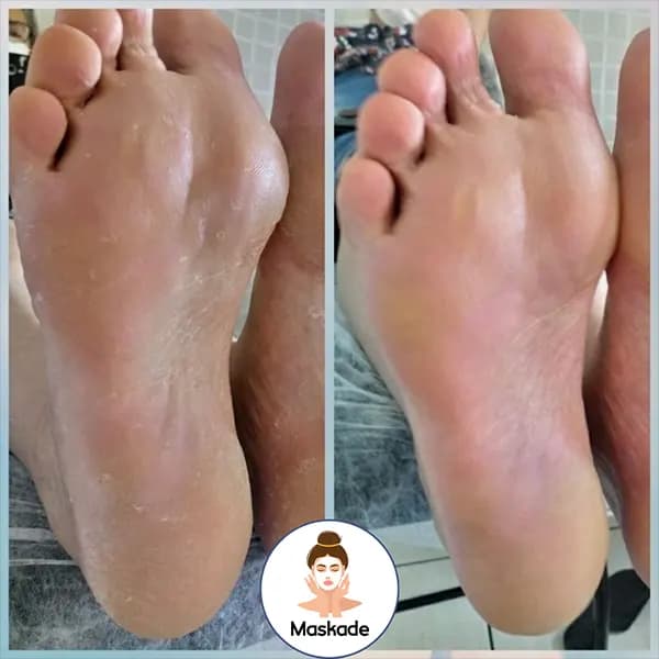 ماسک پا گل رز سادور — تصویر ۴