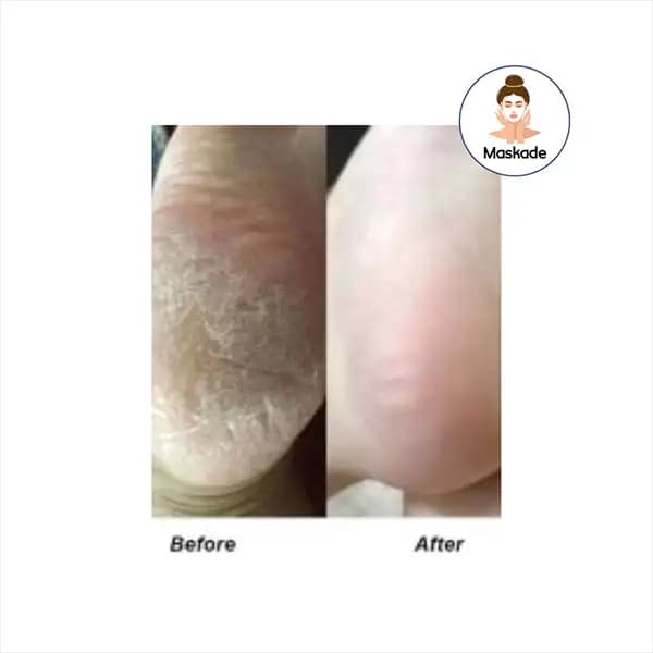 اسپری رفع ترک کف پا راکو — تصویر ۳
