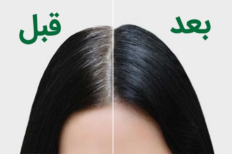شامپو رنگ مشکی لانا 400میل — تصویر ۳