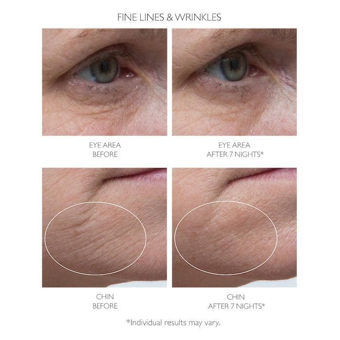 سرم رتینول شب پیتر توماس | Retinol Fusion PM Night Serum — تصویر ۲