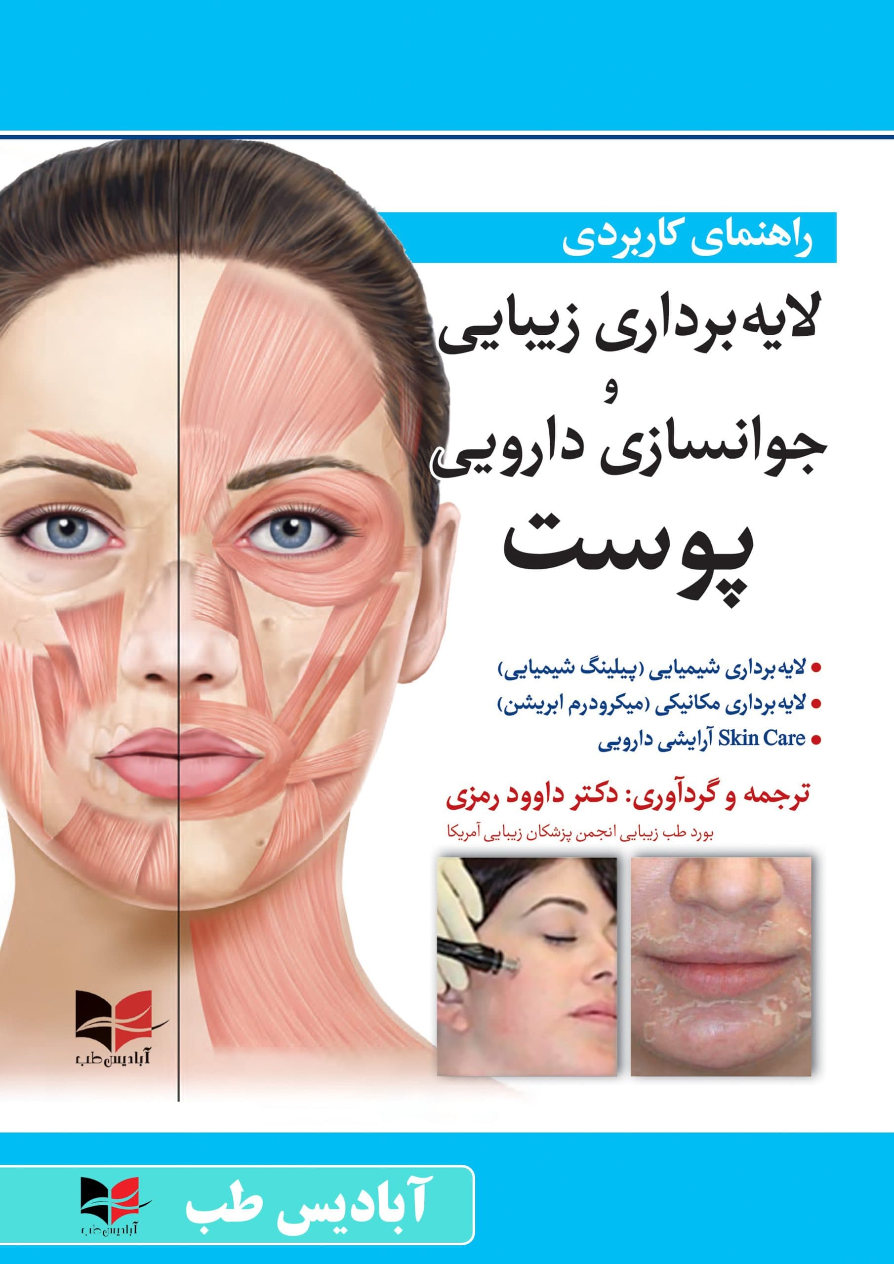 راهنمای کاربردی لایه برداری زیبایی و جوانسازی دارویی پوست | رمزی