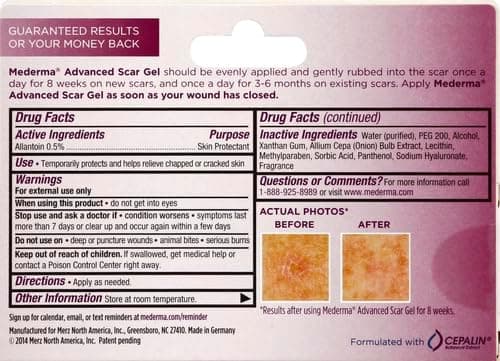 ژل کاهش اسکار مدِرما مدل 862 | Mederma Advanced Scar Gel Daily — تصویر ۳