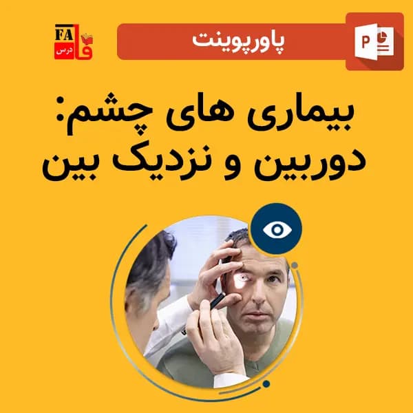 پاورپوینت بیماری های چشم – دوربین و نزدیک بین