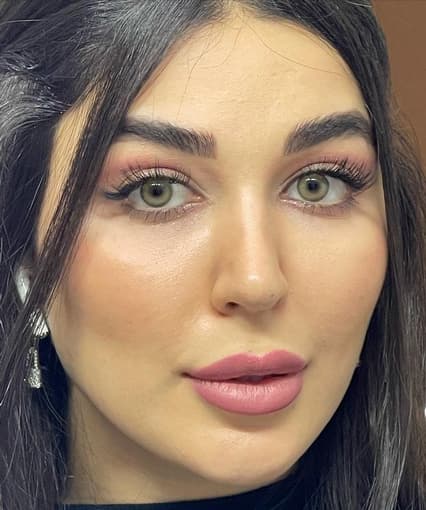 لنز رنگی دهب نچرال گرین — تصویر ۳