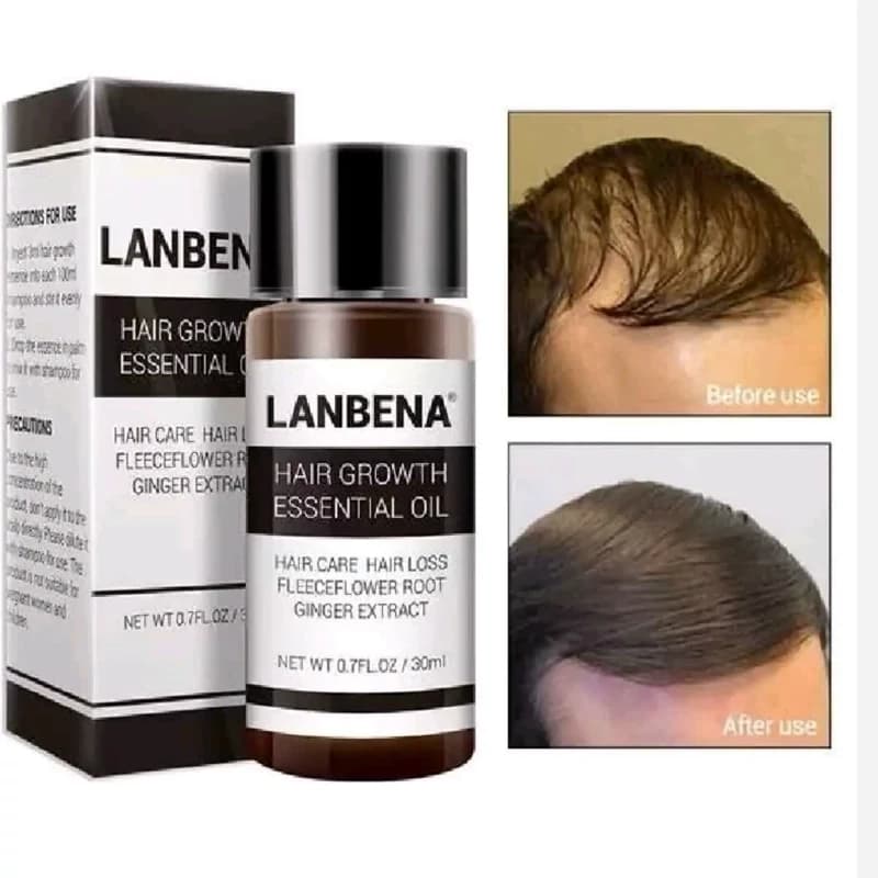 سرم تقویت مو لانبنا (قطره مو لانبنا)