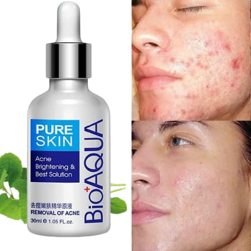 سرم ضد جوش و آکنه صورت برند بیواکوا مدل PURE SKIN — تصویر ۲