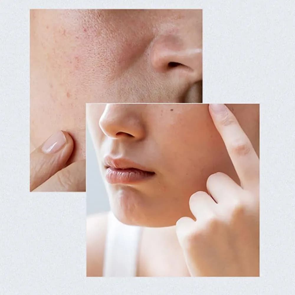 سرم مرطوب کننده و تقویت کننده شیره توس 70% آنوا Anua Birch — تصویر ۲