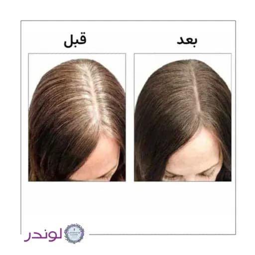 استیک پوشاننده موهای سفید گلدن رز | پوشش فوری ریشه مو — تصویر ۳