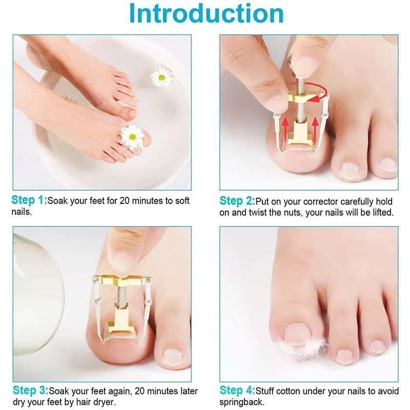 دستگاه اصلاح فرم و ارتودنسی ناخن مدل Nails کد N433 — تصویر ۷