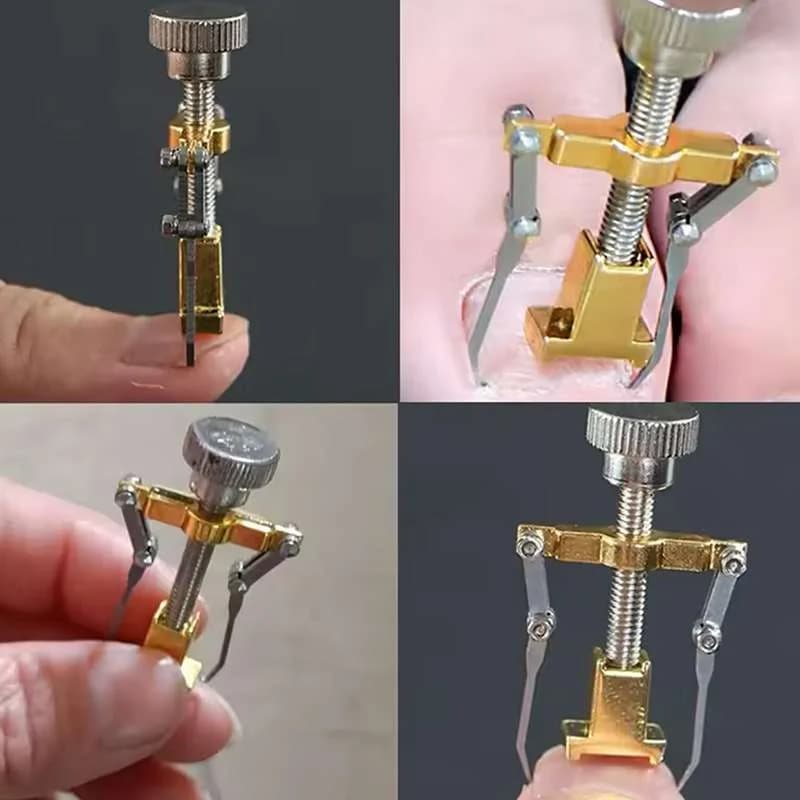 دستگاه اصلاح فرم و ارتودنسی ناخن مدل Nails کد N433 — تصویر ۳