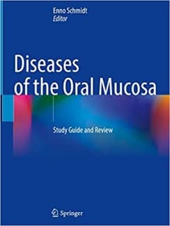 کتاب Diseases of the Oral Mucosa: Study Guide and Review