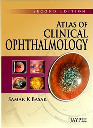 دانلود کتاب Atlas on Clinical Opthalmology