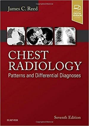 دانلود کتاب Chest Radiology