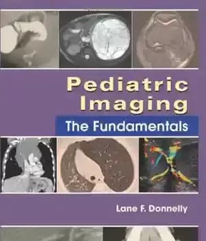 دانلود کتاب Pediatric Imaging: The Fundamentals, 1e – تصویربرداری کودکان: اصول، 1e