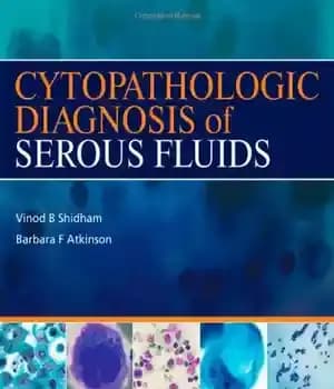 دانلود کتاب Cytopathologic Diagnosis of Serous Fluids – تشخیص سیتوپاتولوژیک مایعات سروز