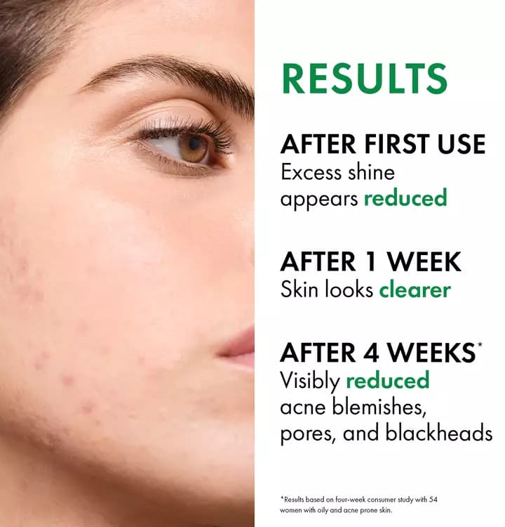 ژل شستشوی نورمادرم ویشی Vichy Normaderm PhytoAction حجم ۴۰۰ میل — تصویر ۳