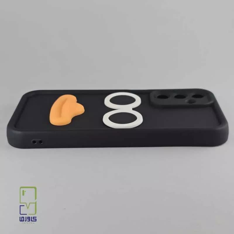 قاب گوشی a15 دخترانه | فانتزی لب و دهن| Samsung A15 — تصویر ۶