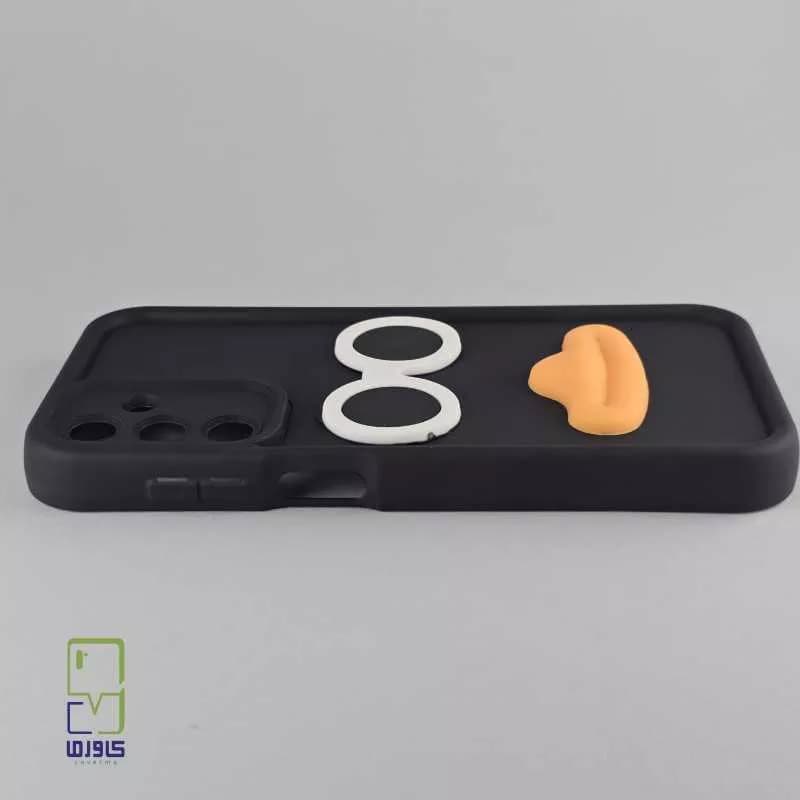 قاب گوشی a15 دخترانه | فانتزی لب و دهن| Samsung A15 — تصویر ۷