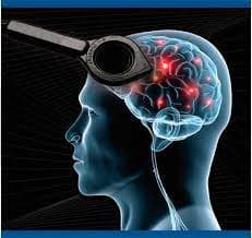 پاورپوینت آشنایی با تحریک مغناطیسی مغز TMS