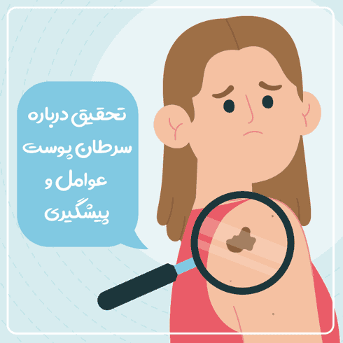 تحقیق درباره سرطان پوست – عوامل و پیشگیری