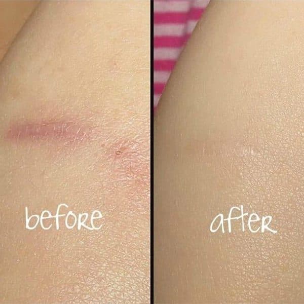 روغن ترمیم کننده بایو اویل پوست بایو اویل BIO-OIL — تصویر ۲