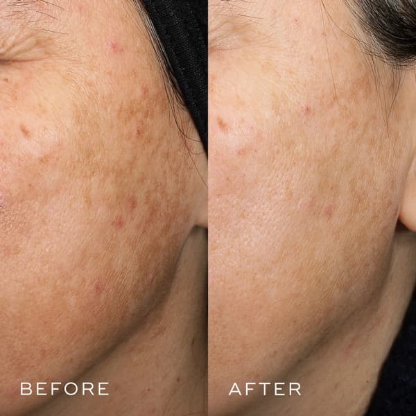 سرم جوانساز، ضدپیری و ضدچروک کریستال رتینال (رتینول) مدیکیت |Crystal Retinal Medik8 serum — تصویر ۷