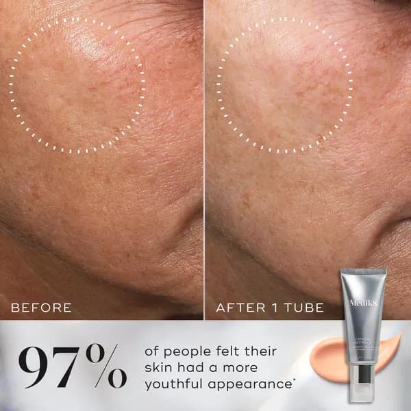 سرم جوانساز، ضدپیری و ضدچروک کریستال رتینال (رتینول) مدیکیت |Crystal Retinal Medik8 serum — تصویر ۵