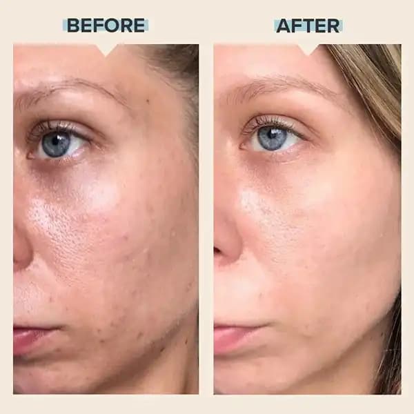 محلول لایه بردار پائولاز چویس اصل | 2% BHA — تصویر ۷