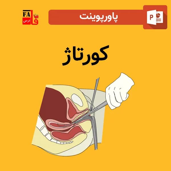 پاورپوینت کورتاژ