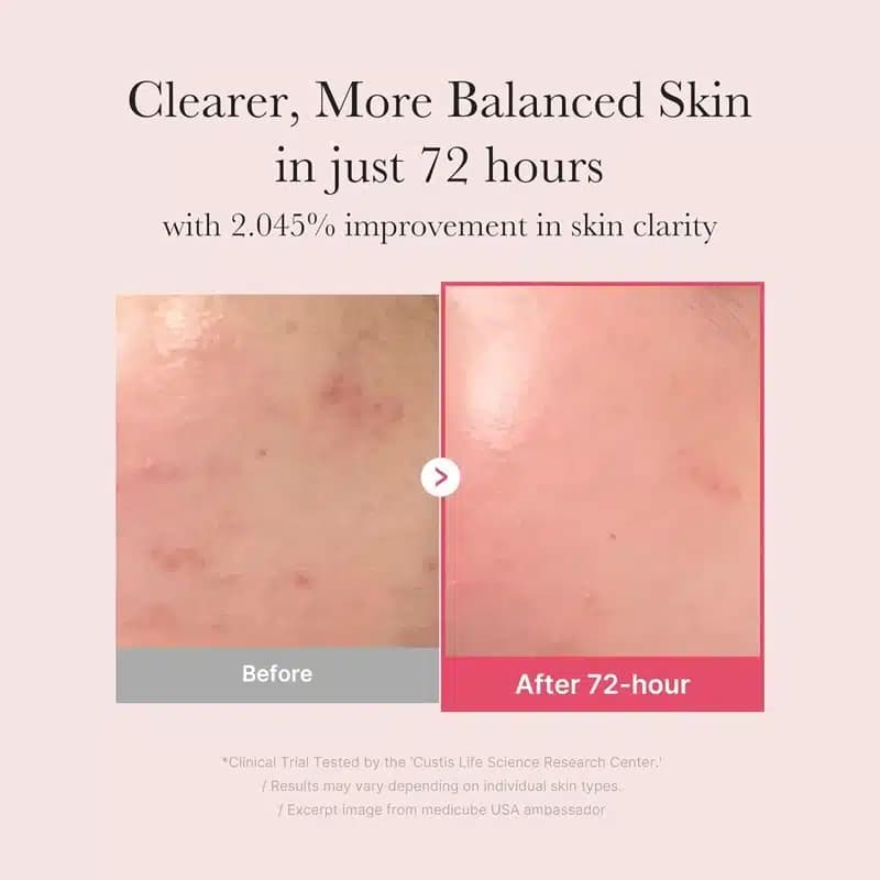 سرم روشن کننده و ضد لک ترانگزامیک اسید و نیاسینامید 15% مدی کیوب Medicube(30 میل) — تصویر ۴