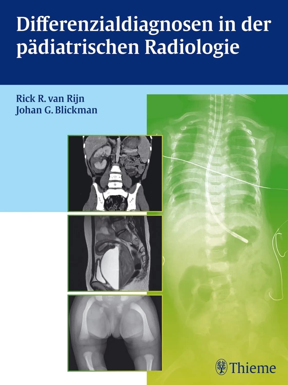 و دانلود کتاب Differenzialdiagnosen in der pädiatrischen Radiologie