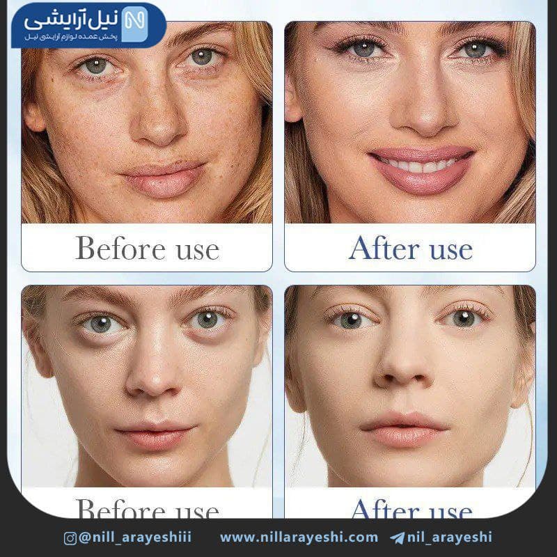 سرم صورت آبرسان هیالورونیک اسید سادور 100 میل کد Sd57386 — تصویر ۴