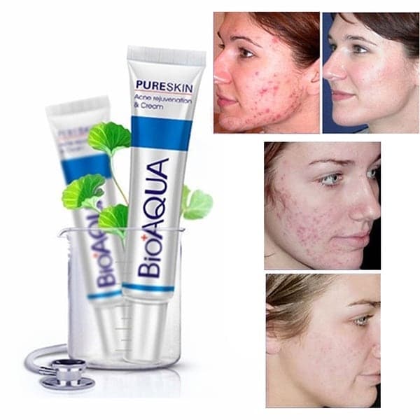 کرم ضد جوش بیواکوا مدل Pure Skin حجم 30 میلی لیتر — تصویر ۲