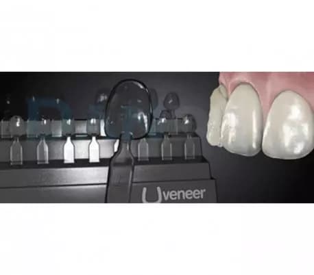قالب پیش ساخته کامپوزیت UVeneer برند Ultradent — تصویر ۵