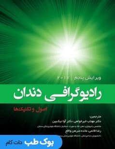 رادیوگرافی دندان اصول و تکنیک‌ها — تصویر ۲