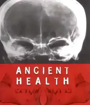 دانلود کتاب Ancient Health: Skeletal Indicators of Agricultural and Economic Intensification – سلامت باستان: شاخص های اسکلتی تشدید کشاورزی و…