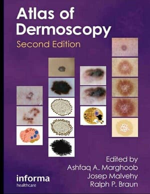 دانلود کتاب Atlas of dermoscopy