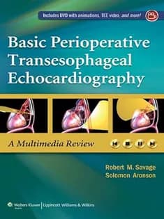 دانلود کتاب Basic Perioperative Transesophageal Echocardiography