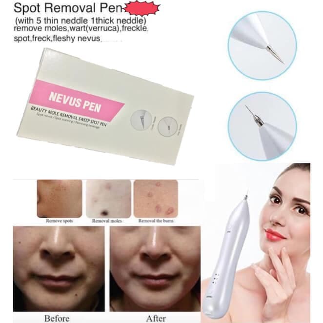 قلم پاکسازی پوست nevus — تصویر ۹