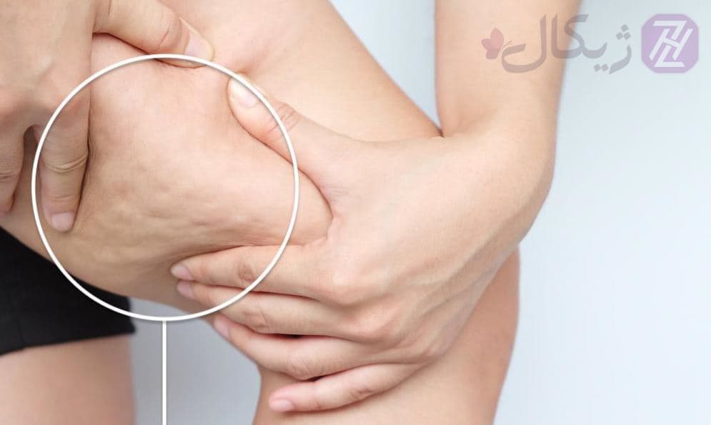 روغن ضد سلولیت دکاسو 500 میلی لیتر — تصویر ۳