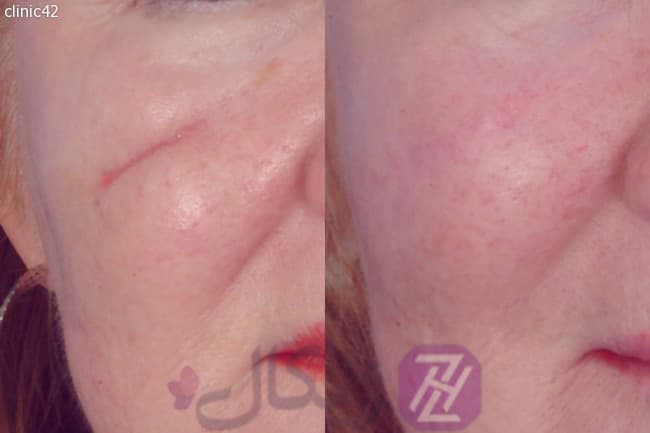 کوکتل بهبود زخم سامون ووگ VOGUE SOMON DNA — تصویر ۲