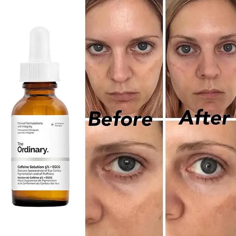 سرم کافئین اوردینری Ordinary caffeine eye serum — تصویر ۳