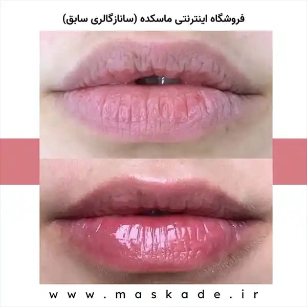 ماسک لب ورقه ای بیواکوا — تصویر ۳