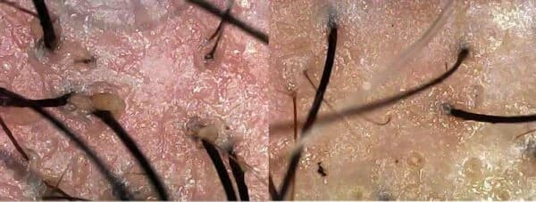 آنالیزور قلمی پوست و مو برند لیز بی سیم — تصویر ۶