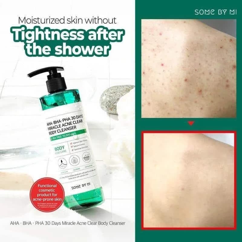 شوینده بدن ضدجوش Miracle سام بای می — تصویر ۳