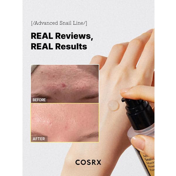 سرم اسنس حلزون کوزارکس مدل Advanced Snail 96 حجم 100 میل — تصویر ۳