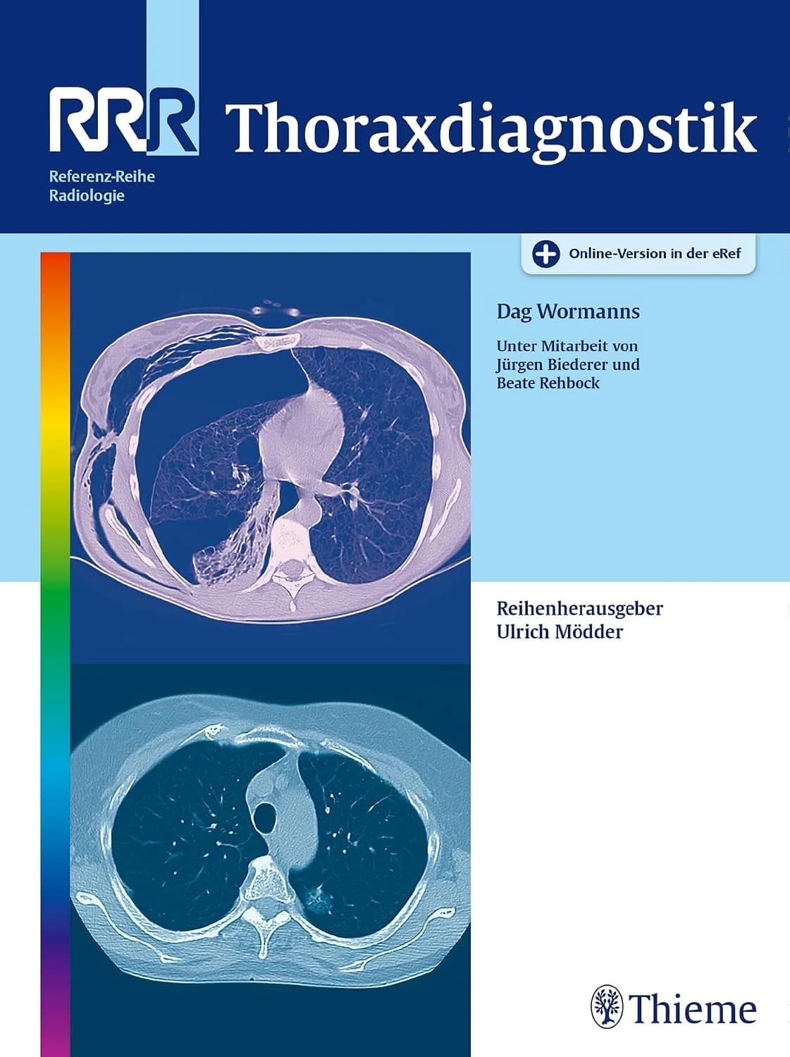 و دانلود کتاب Thoraxdiagnostik: Mit Online-Version in der eRef (Referenz-Reihe Radiologie)