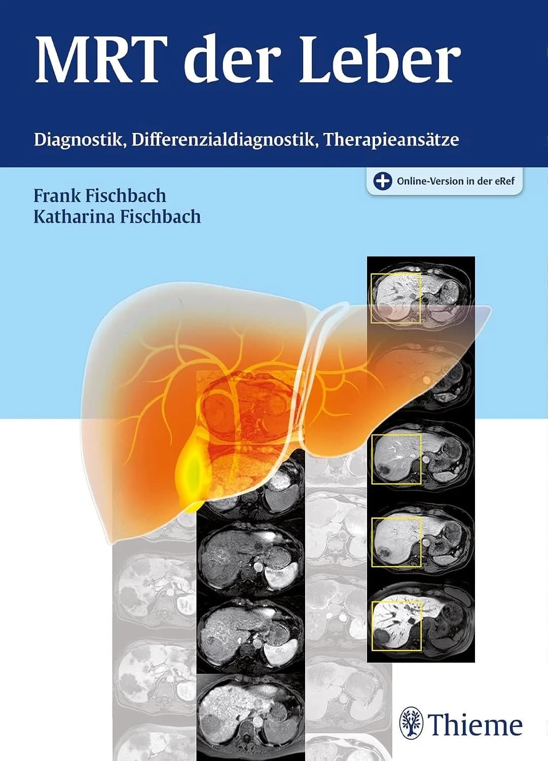 و دانلود کتاب آلمانی MRT der Leber: Diagnostik, Differenzialdiagnostik, Therapieansätze | کتاب خارجی